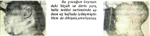 oca90