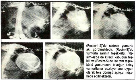 nis92