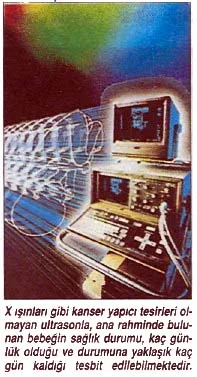 tem92
